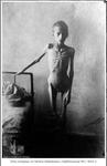 Non-Holodomor: An emaciated child stands for the photographer by her hospital bed in Kherson, Ukraine