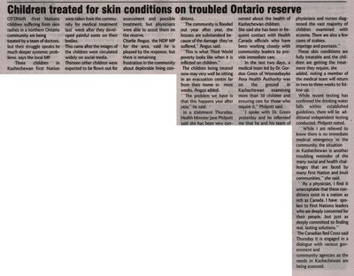 &quot;Children treated for skin conditions on troubled Ontario reserve&quot;